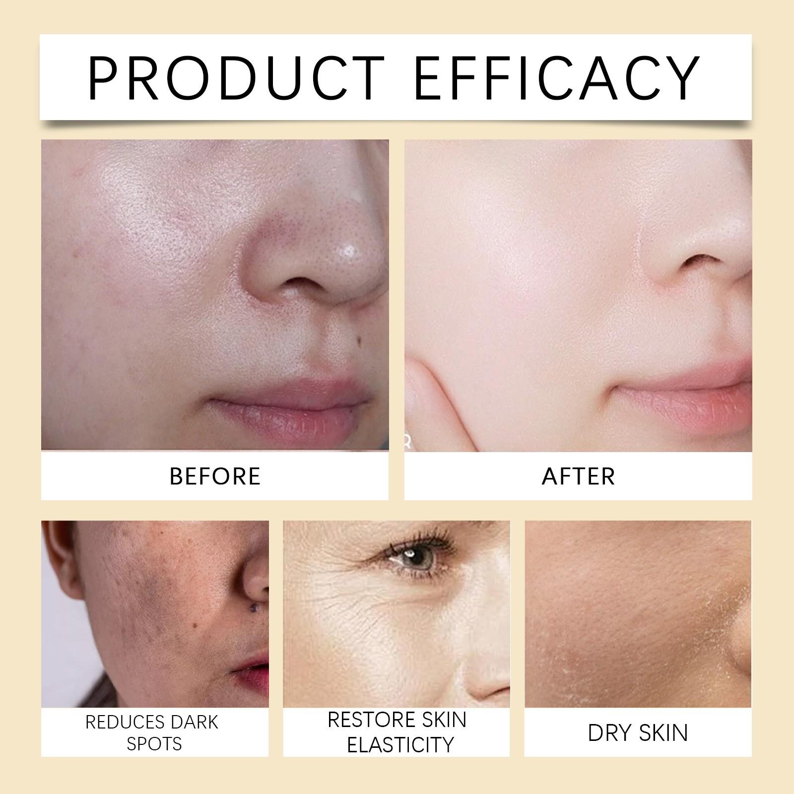 HOYGI Brightening & Whitening Face Cream | Fade Spots, Hydrate & Even Skin Tone | Gentle Ingredients for Sensitive Skin