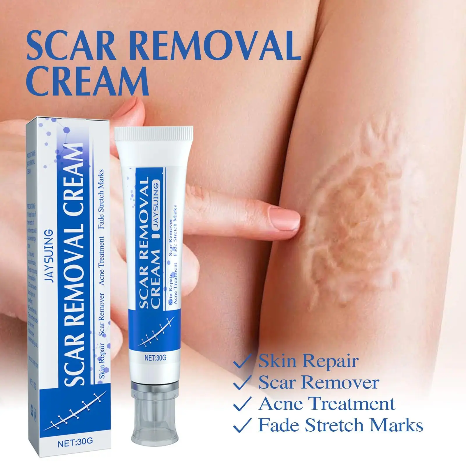 Professional Scar Removal Gels, Advanced Silicone Scar Removal Cream for Burn,Acne Old Scar Removal Cream for Face & Body | Fades Dark Scars Skin Repair