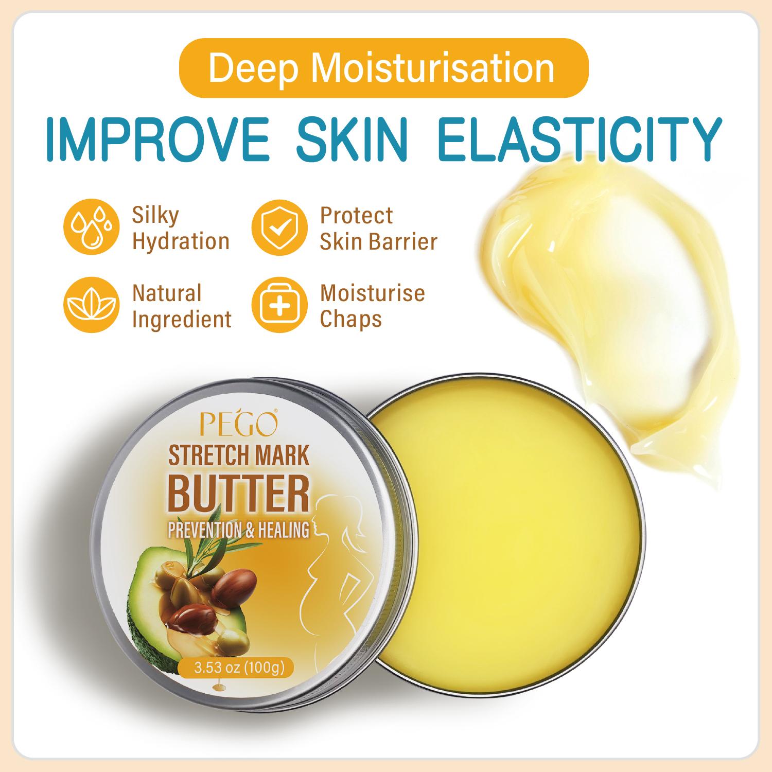 PEGO Stretch Mark Butter, Belly Moisturizer, Pregnant & Breastfeeding - Prevents & Heals Stretch Marks - Formula Enriched with Shea Butter & Vitamin E, 3.53 oz