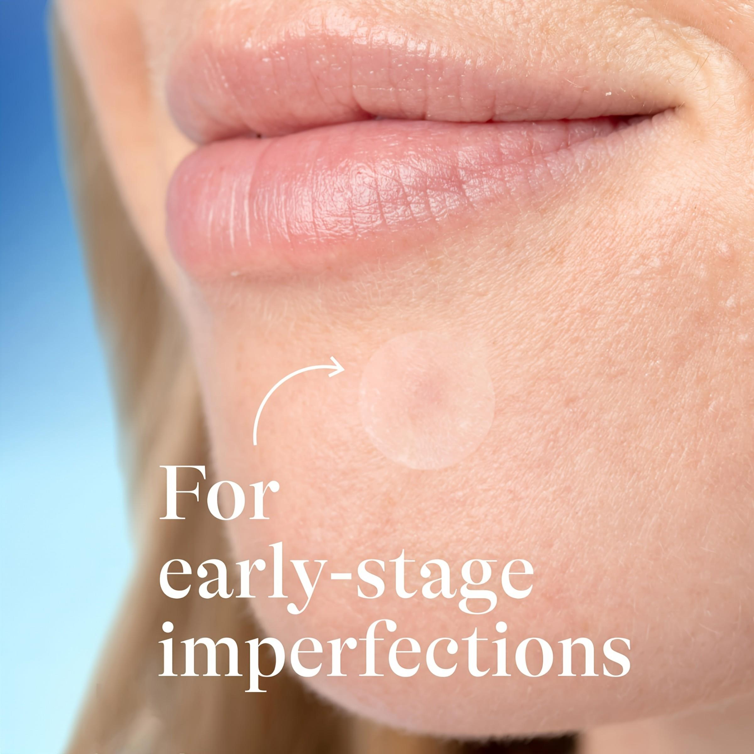 KHAZIX 360cs Skin Mild Protection Patch, Waterproof & Breathable, Easy to Use, Single Item, Made in China, Non-Flammable, No Alcohol/aerosol