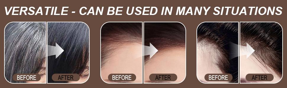 4 Count Hairline Powder Kit - Root Touch Up and Filler for Women, Hair Color Powder with Brush for Hairline Daily Ash Brown Blonde Balayage