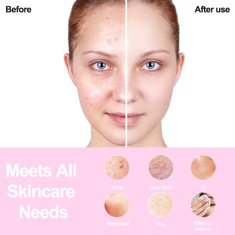 Facial Cleansing Brush Skin Massager Electric Silicone Face Brush USB Cleansing Waterproof Sonic Vibration summervibes