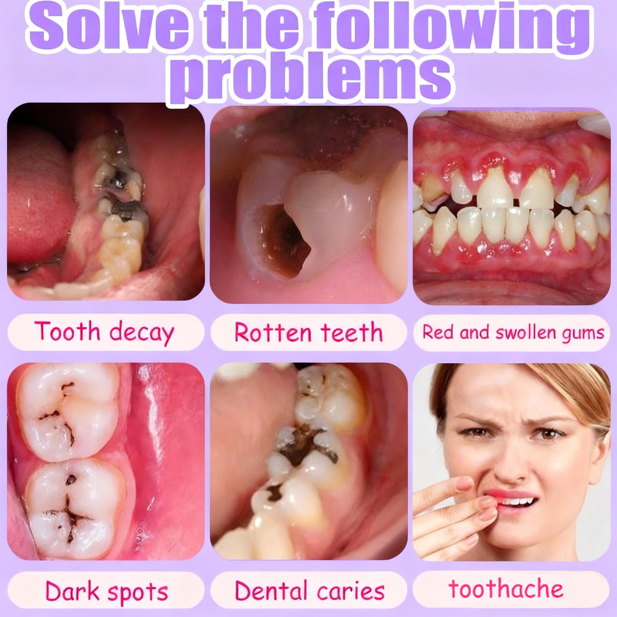 Sensitive Teeth Cavity Protection Toothpaste, Extra Strength Enamel Support, Professional Anti-Decay Formula, Soothing Mint for Fresh Breath & Gum Health, Daily Defense. Sensitive Teeth Cavity Protection Toothpaste, Extra Strength Enamel Support, Professional Anti-Decay Formula, Soothing Mint for Fresh Breath & Gum Health, Daily Defense.