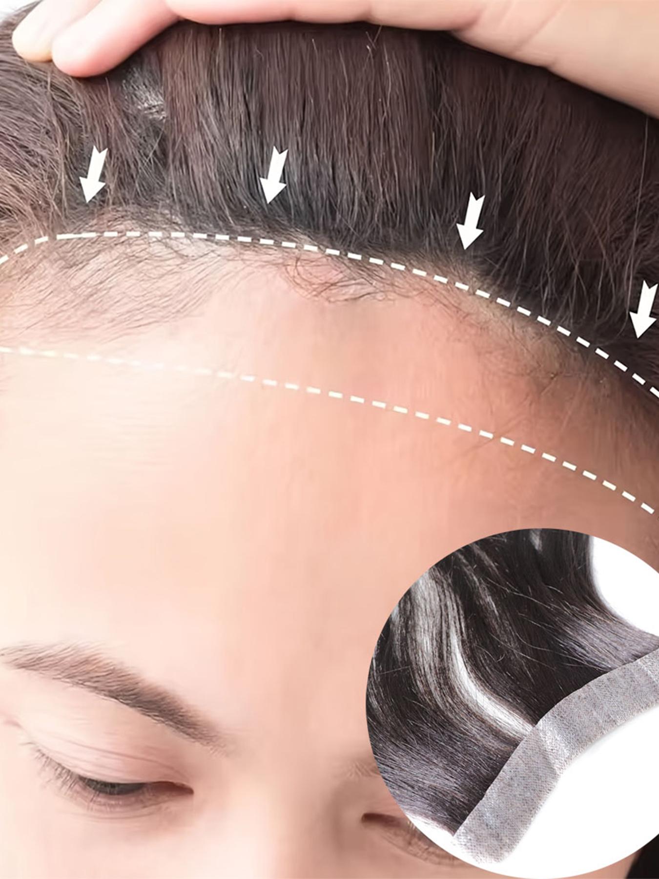 30.48cm Straight Human Hair Frontal Hairline Hairpiece for Men, Natural Invisible Hairline Patch, Lightweight & Comfortable, Easy to Wear Baldness Solution, Ideal Christmas Gift