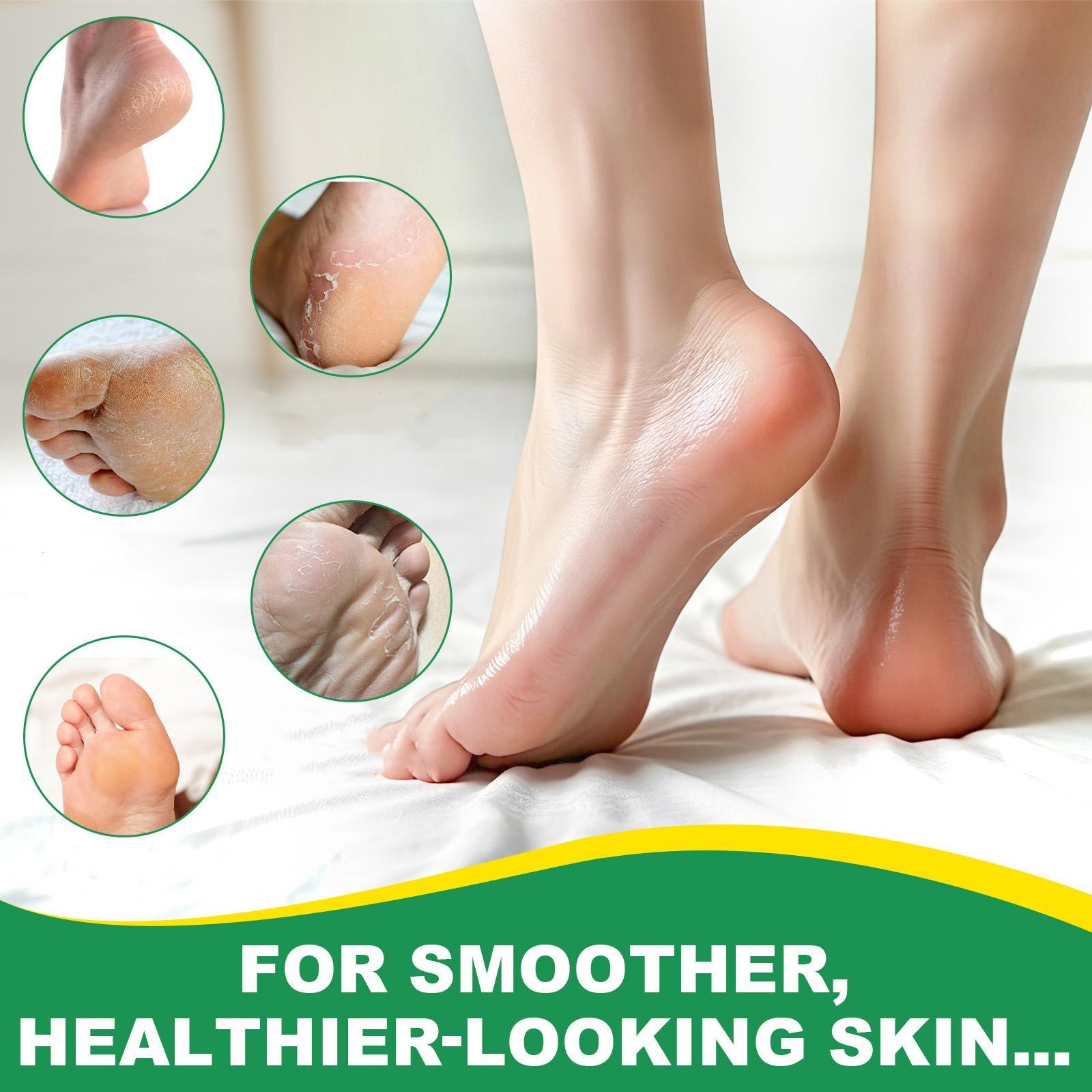 ELAIMEI Aloe Vera Skin Care Stick, containing ingredients such as urea and salicylic acid, softens rough skin, quickly moisturizes dry areas, soothes dryness, and provides long-lasting hydration.