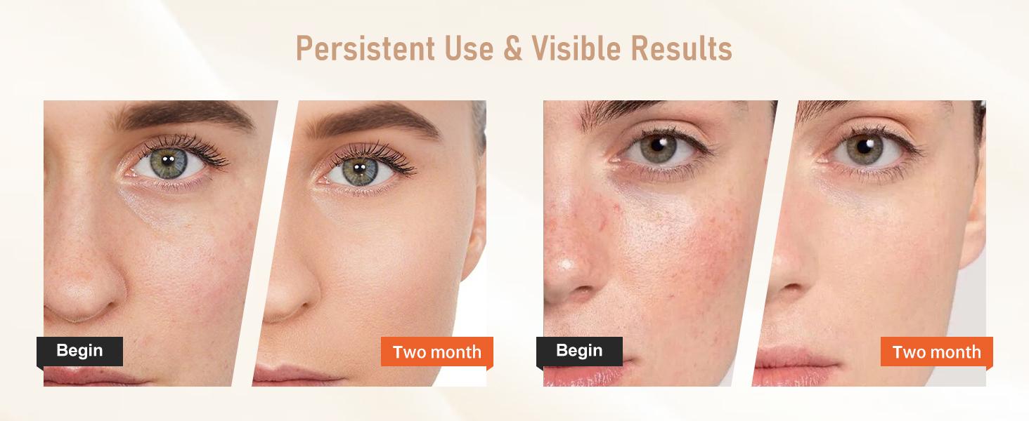 Red Light Therapy for Face, 7 Modes Portable Led Face Mask Light Therapy with Remote Control, LEDs face mask & neck mask Red,Advanced Skincare Made Easy,Timing Function, Red Light Therapy at Home Facial Glow Red Light Therapy for Face, 7 Modes Portable Led Face Mask Light Therapy with Remote Control, LEDs face mask & neck mask Red,Advanced Skincare Made Easy,Timing Function, Red Light Therapy at Home Facial Glow