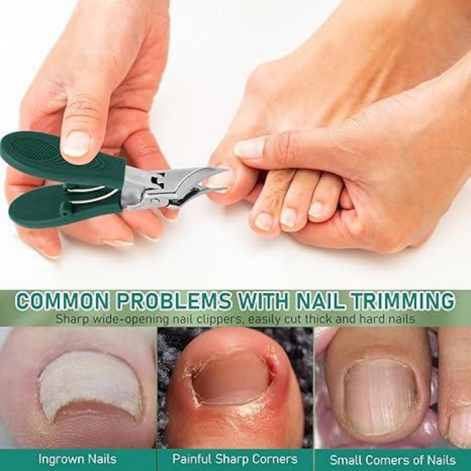 3-Counts Sets of Eagle Beak Beveled Nails Clippers,Wide Jaw Opening Anti-Splash Slanted Nail Clipper,Oblique Ingrown Toenails Clipper,for Thick Nails and Ingrown Care.