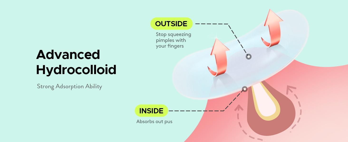 LitBear Skincare Hydrocolloid Pimple Patches - 7 Sizes, 306 Count, XL Spot Treatment, Acne Stickers, Pimple Extraction Aid, Back Care, Lifting & Firming Skin Products, Travel Essential, Mother's Day Gift