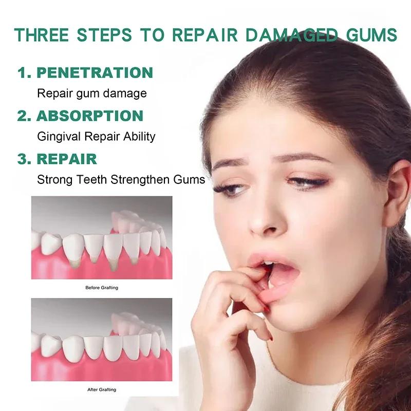 Gum Repair Drops Relieve Receding Gingival Swelling Gum Cleaning Care Oral Periodontal Hygiene Remove Yellow Tartar 2024 New