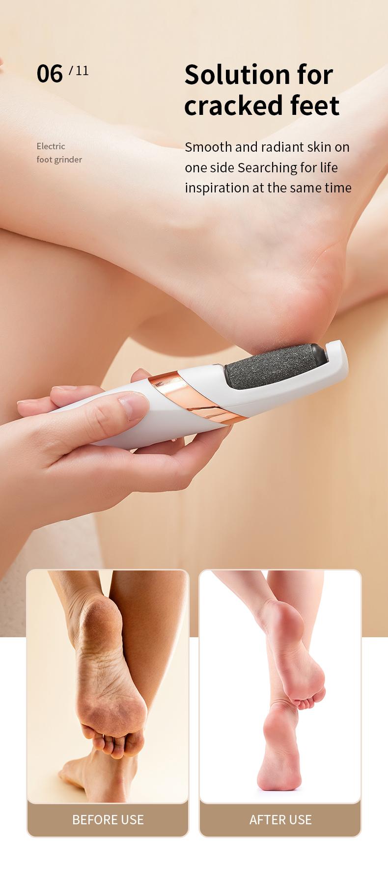 Electric Feet Callus Remover, Electronic Foot File Pedicure Tools,Waterproof Foot Scrubber File,Pedi Foot Care for Dead,Hard Cracked Dry Skin Manicure Nail Nail Care Cutics Nail Art white Compact Daily footcallusremover nail drill Electric Foot File