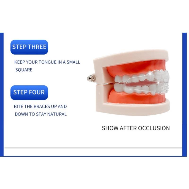 Silicone orthodontic braces Product with Storage Case, Comfortable to Wear, Safe to Use, Suitable for Both Men and Women