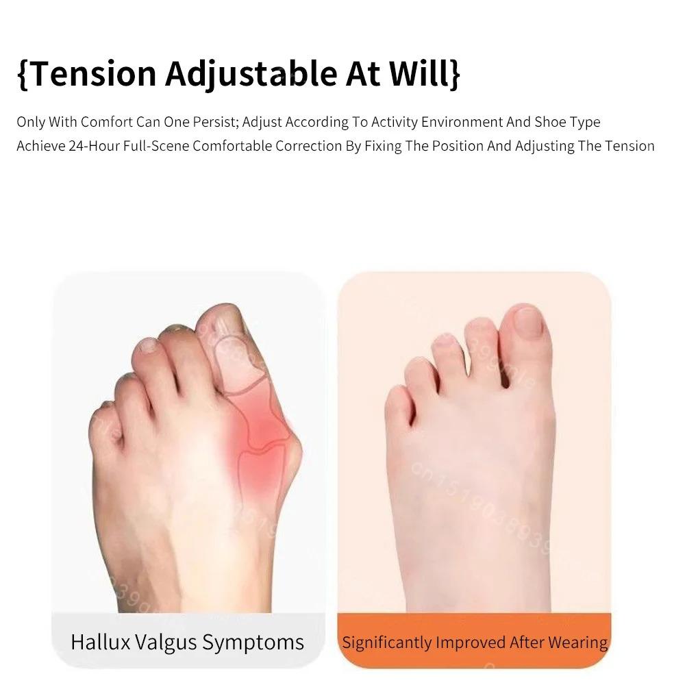 Orthopedic Bunion Corrector Strap, Orthopedic Toe Straightener, Toe Corrector Sleeve, Breathable Toe Separator for Hallux Valgus Correction, Universal Fit Big Toe Support