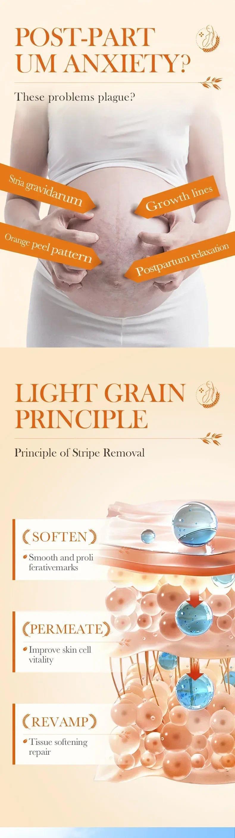 HOT SALE Stretch Marks Permanent Removal Eliminate Body Belly Stretch Marks Swelling Marks Remove Skin Cracks Repair Firming Car