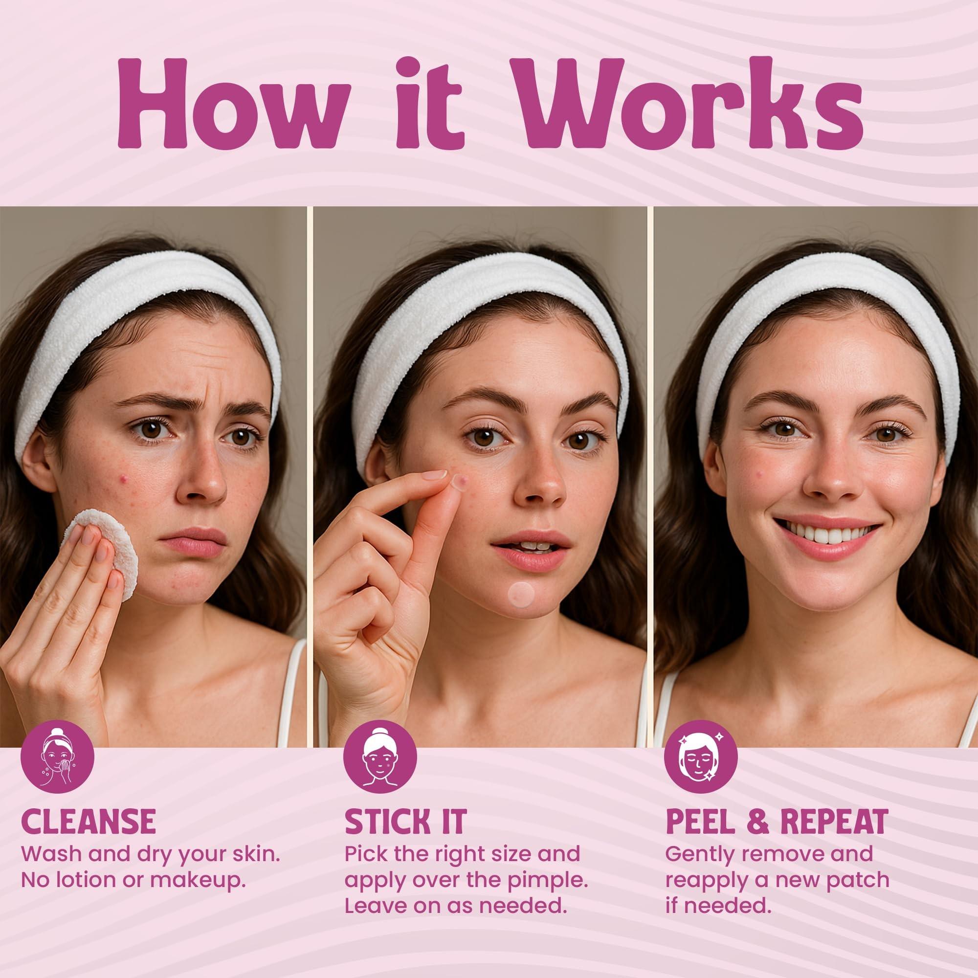 288pcs High-Quality Water Gel Patch, Concealer Patches & Covers, Gentle Non-Irritating, Waterproof Breathable, Essential Facial Skincare Product
