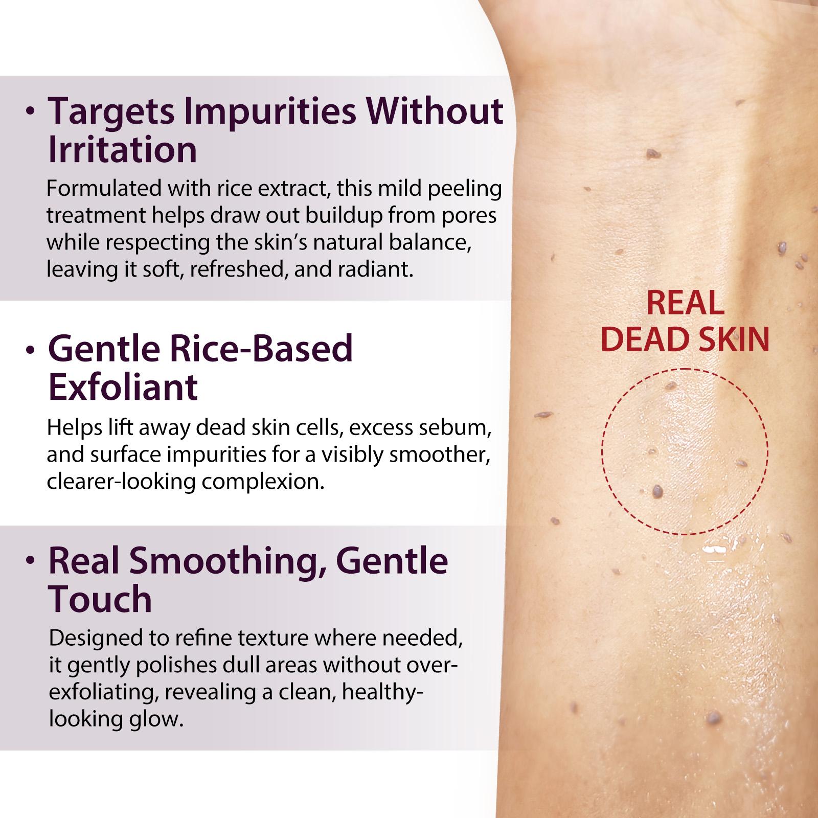 ikzee Black Rice Exfoliating Ampoules 100ml, Hydrating Exfoliant, a gentle mild daily exfoliating scrub for face and body, brightens and removes dead skin cells from all skin types, a daily skincare product.