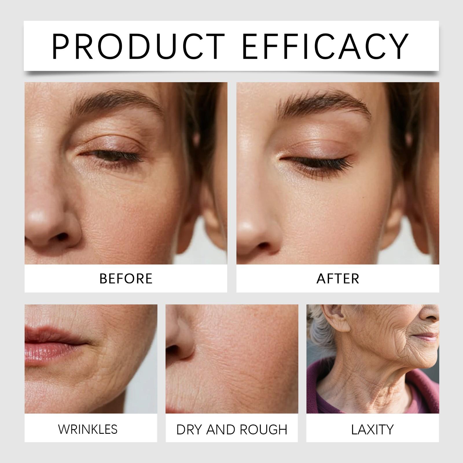 Moisturizing Face Cream, Hydrating Facial Care, Smooths Skin Texture, Enhances Elasticity, Clearer Lines, Soft & Silky Application