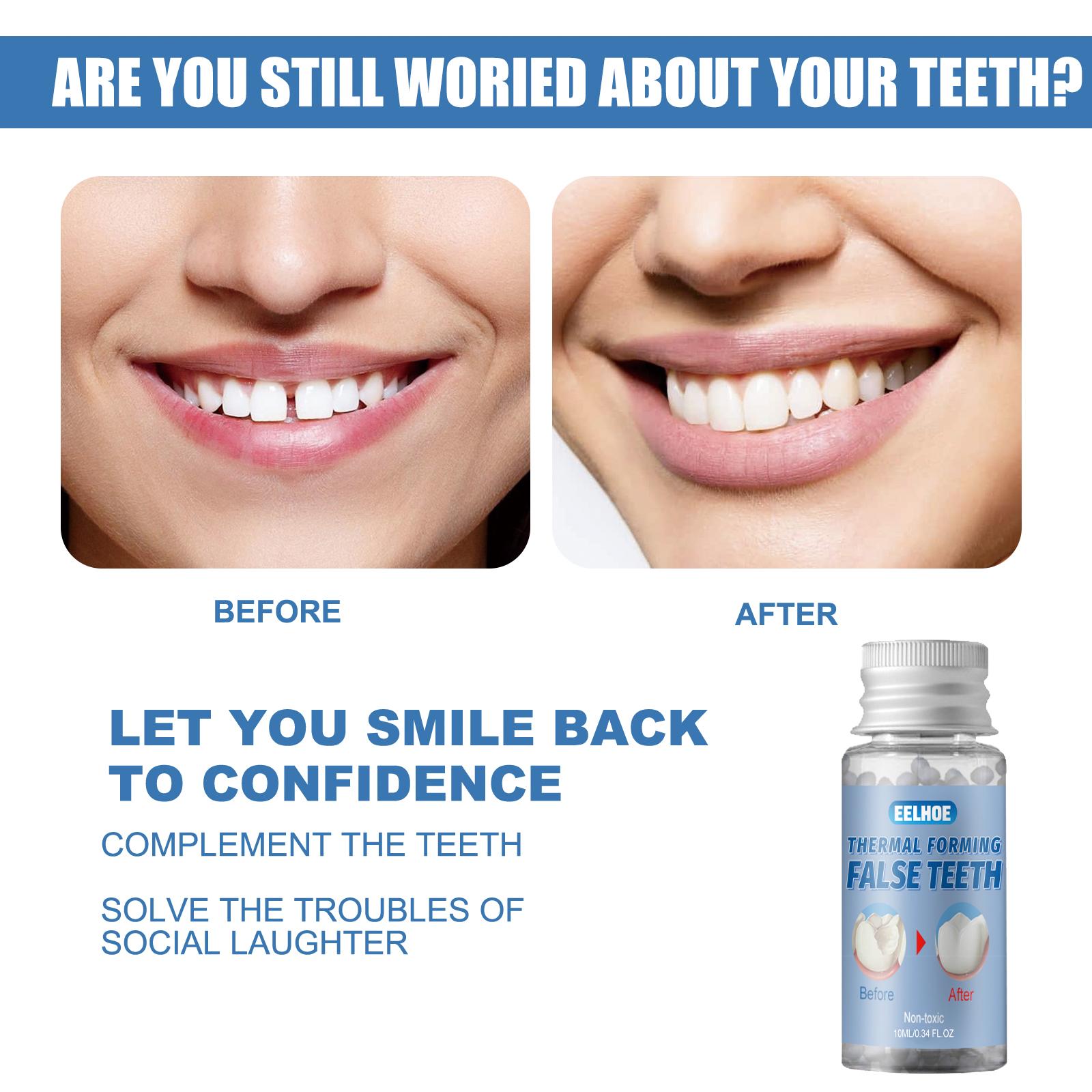 30ml Shapeable dentures, dental glue, film,makeup, temporary filling, dental glue, false filling, broken teeth, gaps filling