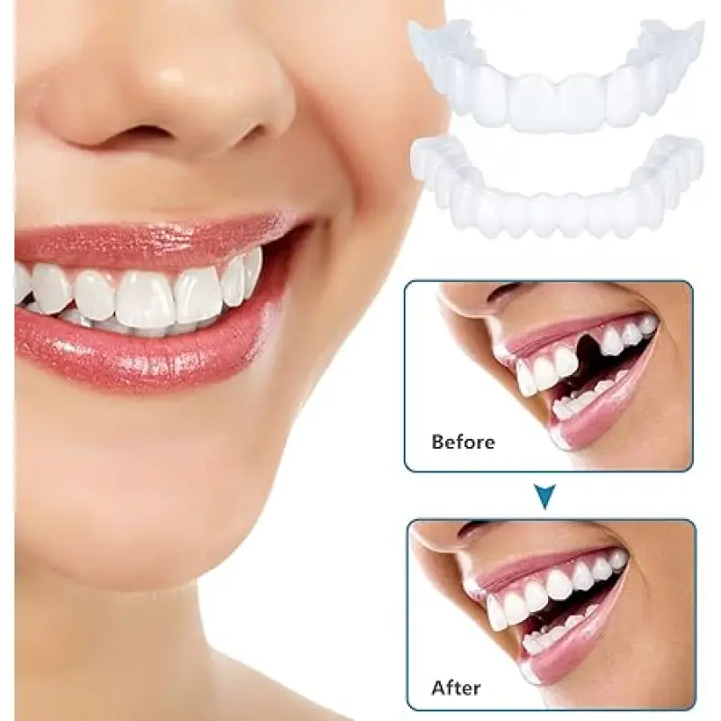 Radiant Oral Instant Smile Clip-In Set - 2-Pair Fake Dentures, Cosmetic Teeth Covers, Top + Bottom Whitening Effect Dental Accessories, Portable Stain Concealer for Confidence Boost