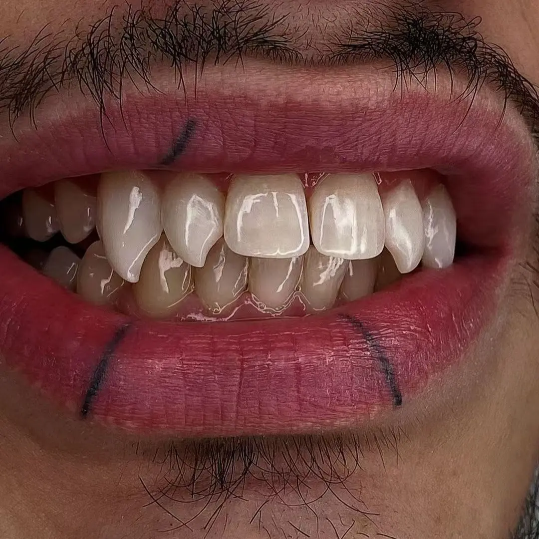 8pcs Vampire Fangs for Men & Women - 4 Length Adjustable Hip-Hop Gothic Teeth Accessories Suitable for Cosplay, Parties, Music Festivals, Year-Round Wear -  Supernatural Color Fang Teeth Gifts for Daily Wear & Themed Events