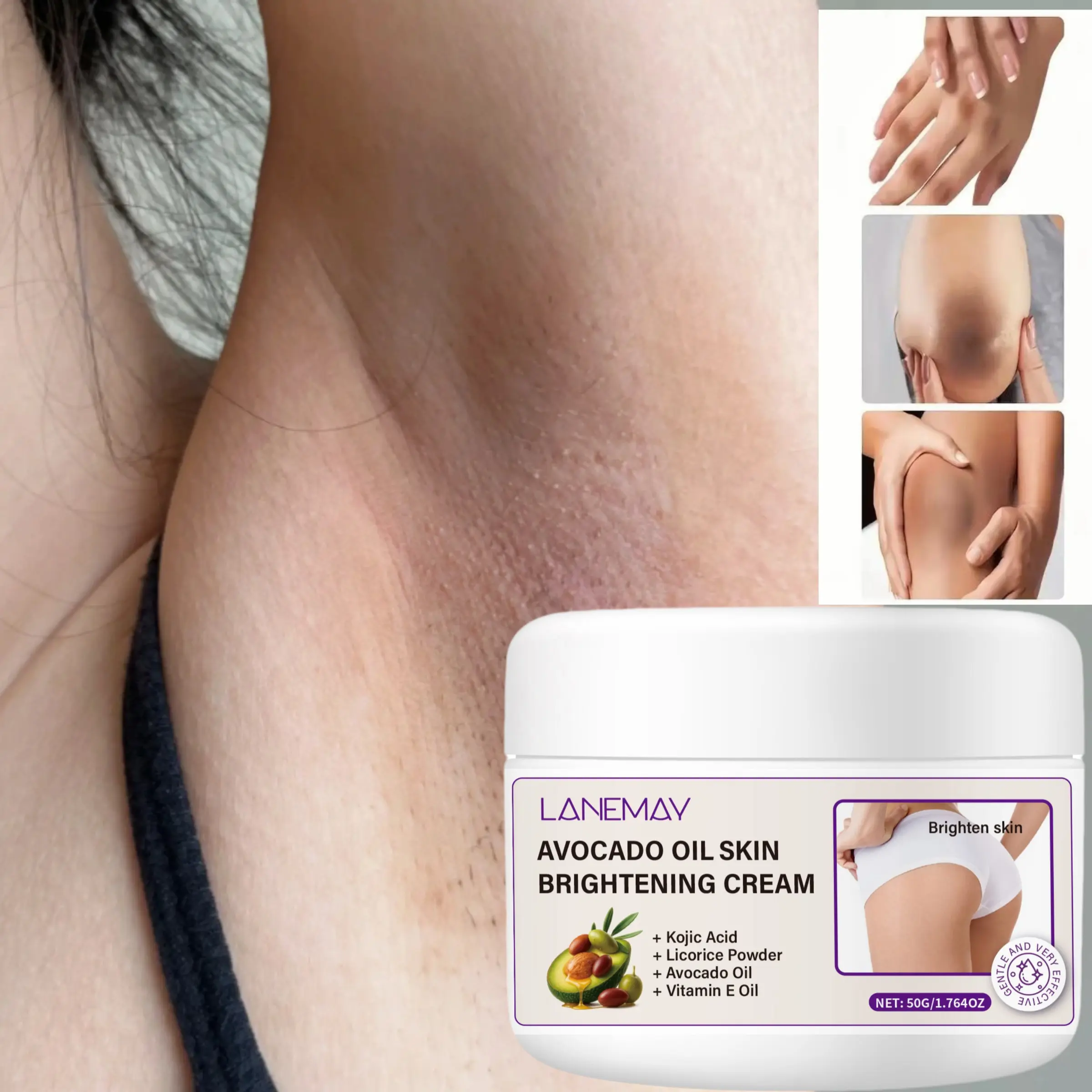 Avocado Kojic Brightening Cream for Body, Intimate Areas, Armpits, Knees, Elbows, Inner Thighs, Bikini Area, Lightens Dark Spots, 50g