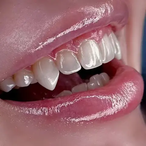3-Piece Vampire Fang Set with Adhesive Beads, 17mm Plastic Teeth for Costume Parties, Halloween, Fun Holiday Gift, Carnival Accessory, Cosplay Makeup