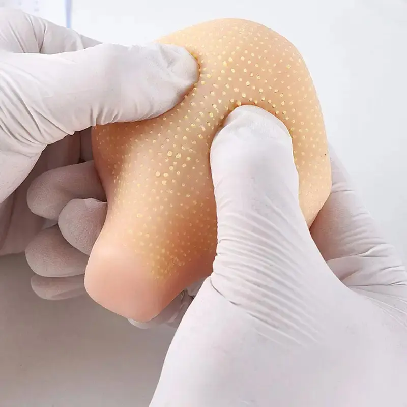 Realistic Pimple Popper Fidget Toy Silicone Sensory Stress Reliever For Anxiety, Simulation Blackhead Squeezing Toy Model