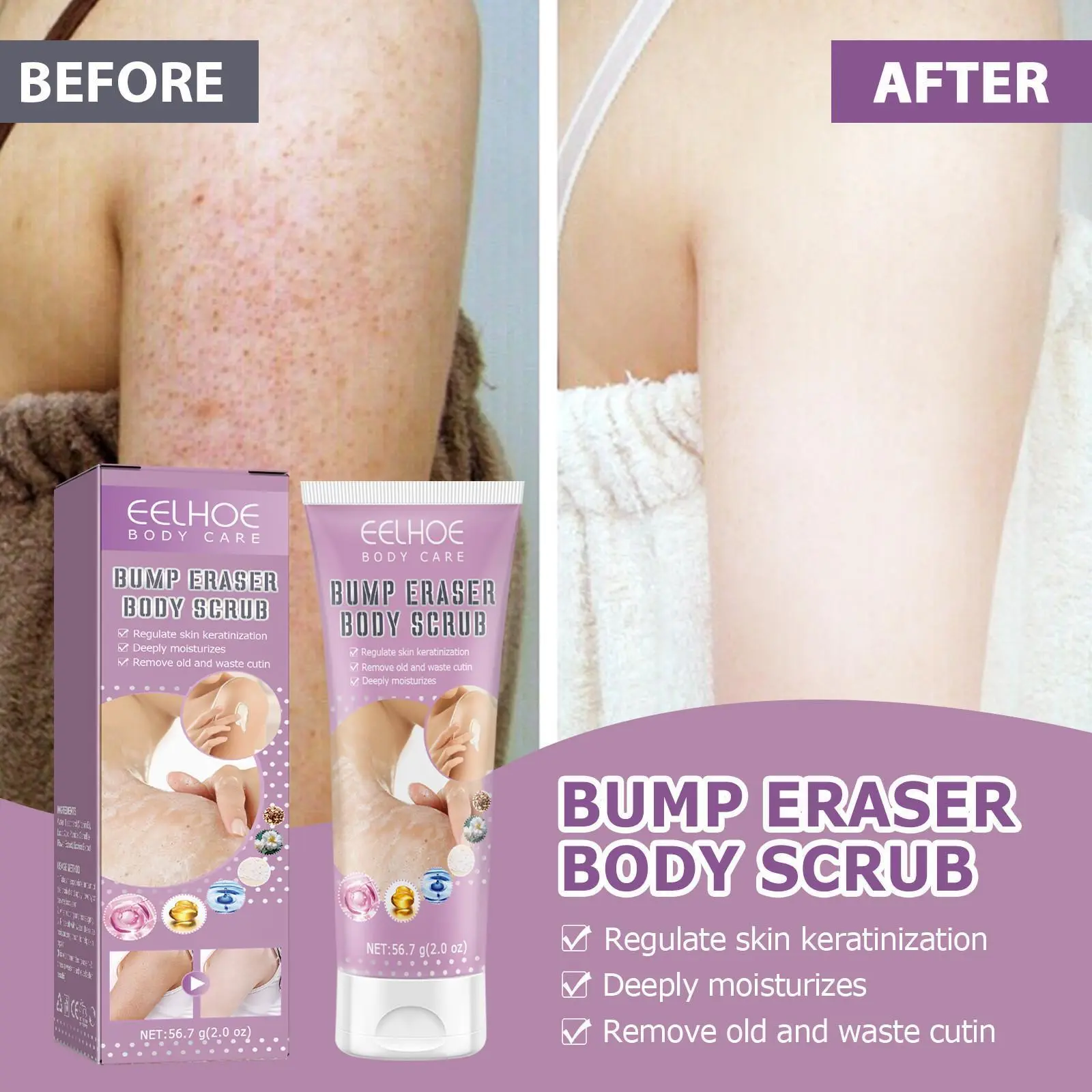 Transform Rough Skin! Body Scrub Targeted for Hair Keratosis