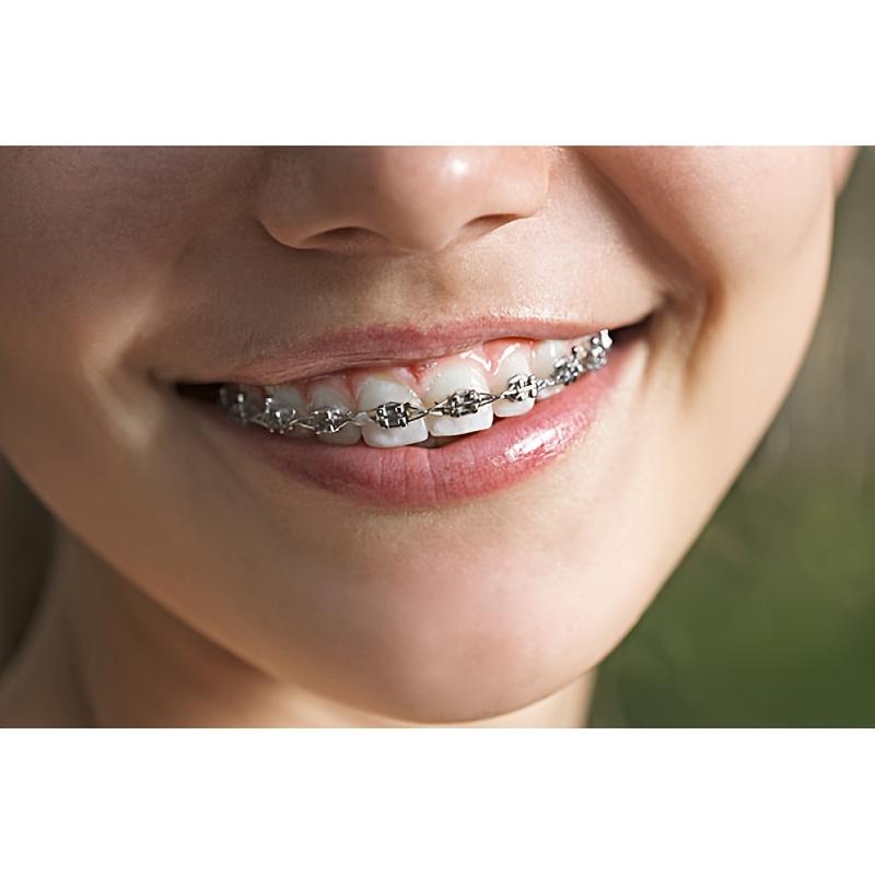 Colorful Temporary Teeth Decorations |                      Braces with Rubber Bands & Stainless Steel |                       Vibrant Party Style for Halloween, Thanksgiving, Christmas |                       Durable, Easy-to-Use Beauty Retouching Gear M