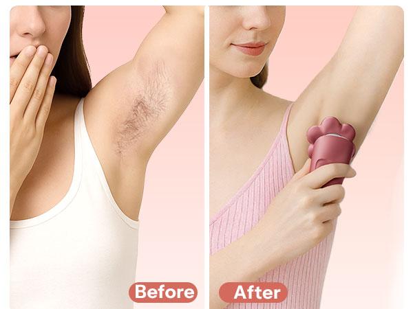 HiBig 7D Electric Legs & Body Shaver for Women - 5-in-1 Lady Grooming Kit for Bald Head, Legs & Armpits, Waterproof Rechargeable Painless Razor, Cordless Shaver with Floating Heads, Ideal Gift for Her HiBig 7D Electric Legs & Body Shaver for Women - 5-in-1 Lady Grooming Kit for Bald Head, Legs & Armpits, Waterproof Rechargeable Painless Razor, Cordless Shaver with Floating Heads, Ideal Gift for Her