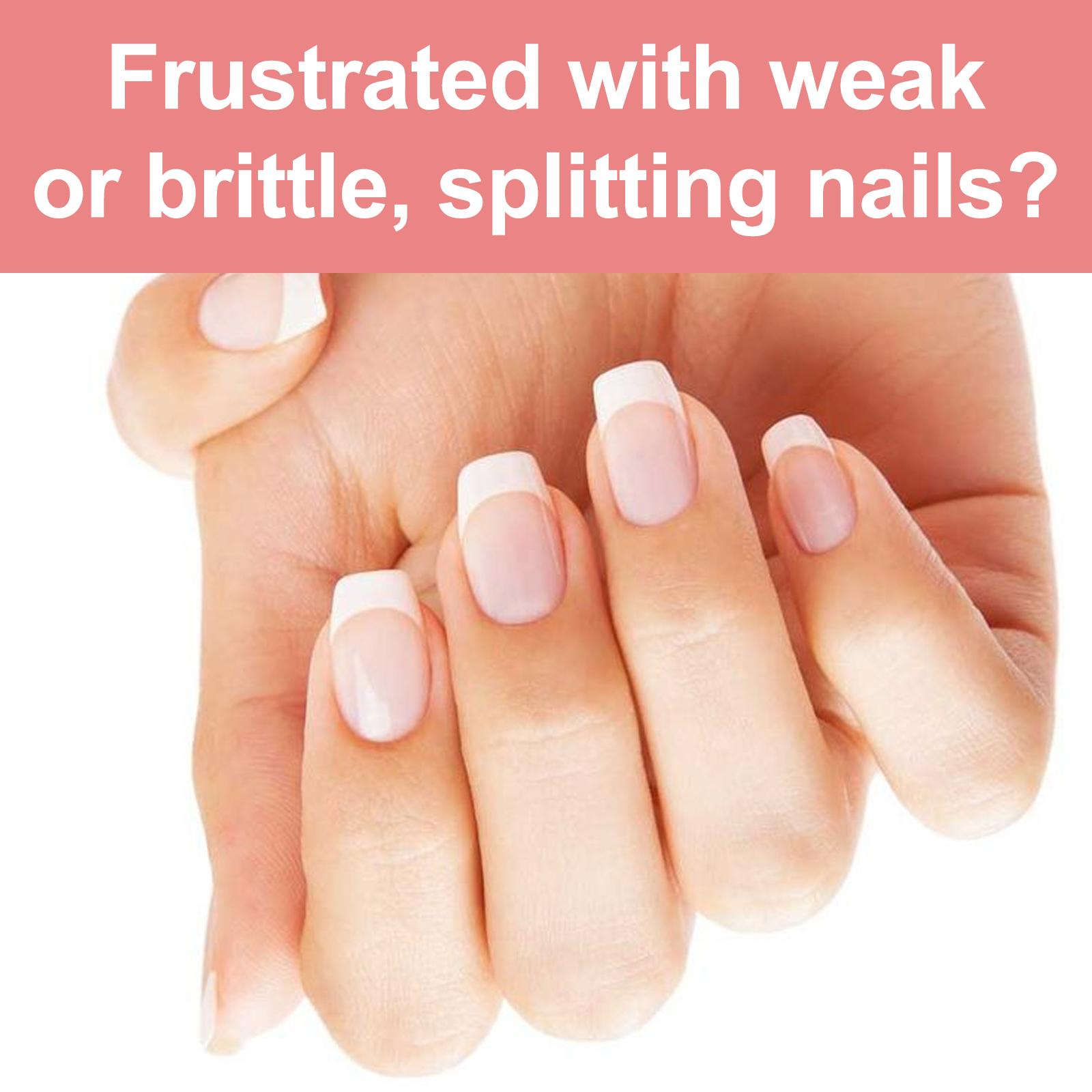 Long-lasting Nail Strengthener, Nail Care Gel, Natural Drying Finish Nail Care, Nail Care for Hands and Feet, Nail Care Liquid