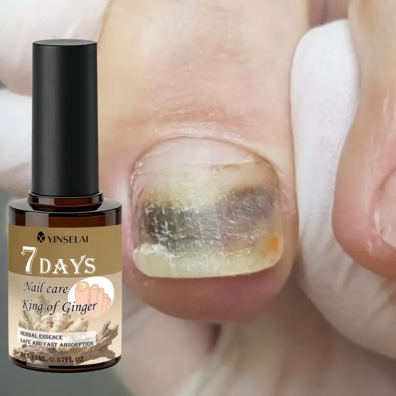 Turmeric 24h nail care essence Nail Care Liquid - containing vitamin E and turmeric, suitable for yellowing, abrasion, roughness, fracture, uneven appearance of nails, keeping nails in good condition, suitable for all nail types