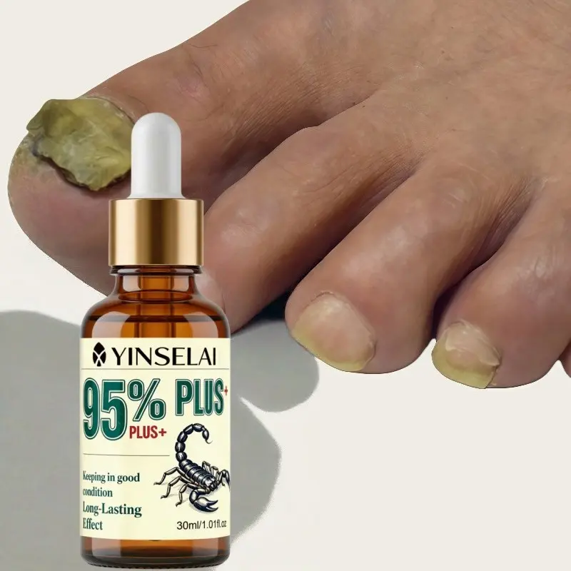 Ultra-Powerful 95% Scorpion Venom Nail Strengthener, Contains Bee Venom & Ginger Extract, 24-Hour Care for Thickened & Damaged Nails, Nail Care Product