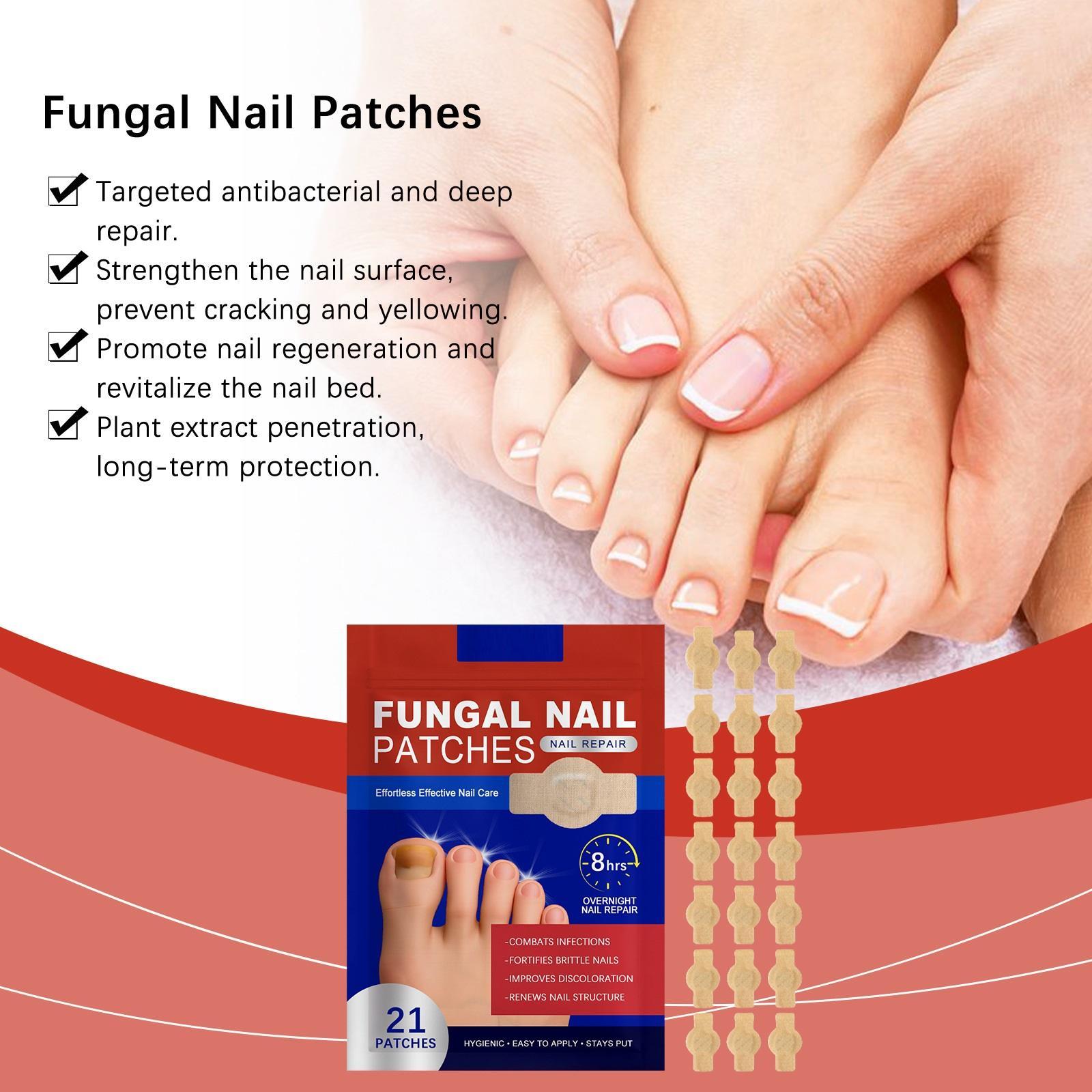 Fungal Nail Patches, 21pcs/box Nail Health Care Patches, Effective Solution for Fungal Nails & Nail Problems, Daily Nail Care Kit
