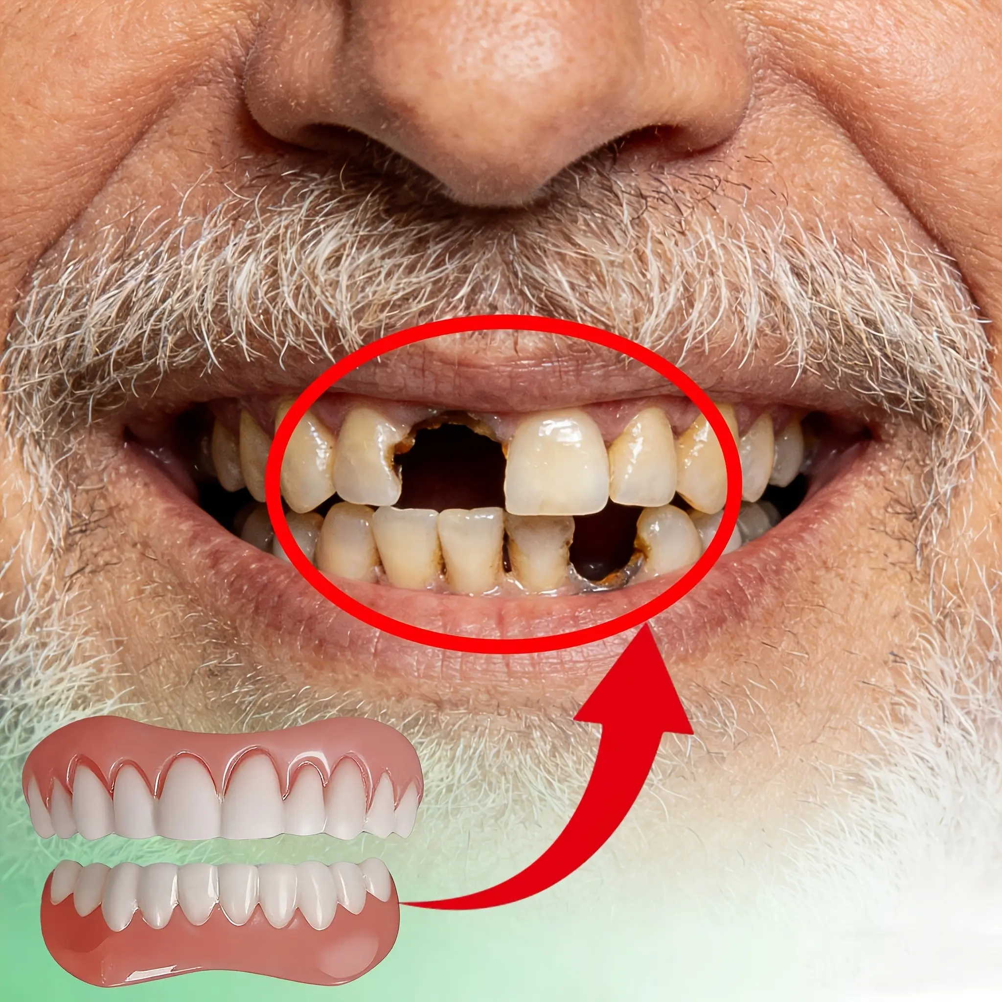 Teeth Veneer Set - Designed for Individuals with Missing Teeth Or Large Gaps Between Teeth, Easy Design, No Foreign Body Sensation, Convenient for Temporary Wear, Renews a Confident And Beautiful Smile, Perfect Gift