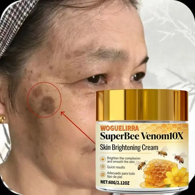 Bee Venom Facial Cream Moisturizer with Retinol, Nicotinamide, Vitamin C, Brightens Skin, Evens Tone, Moisturizes, Reduces Dark Spots, for All Skin Types, Hydrating