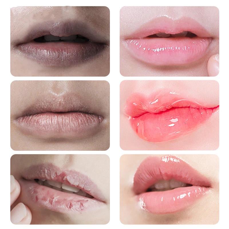 Remove Dark Smoke Lips Pink Fresh Lightening Bleaching Cream Treatment Lip Balm  Moisturizer Nourishing Essence Lips