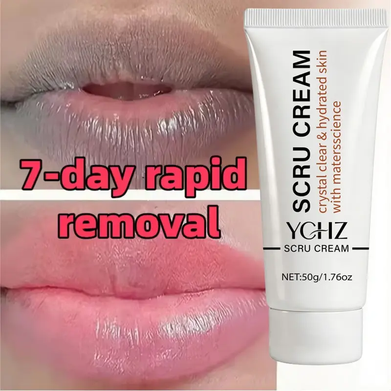 Quick-Acting Whitening Lip Exfoliating Gel, Spot Reducing, Moisturizing Balm, Essence, Exfoliates, Fades Lip Lines, Removes Dead Skin, Nourishes, Lip Care, Makeup, Lip Treatment