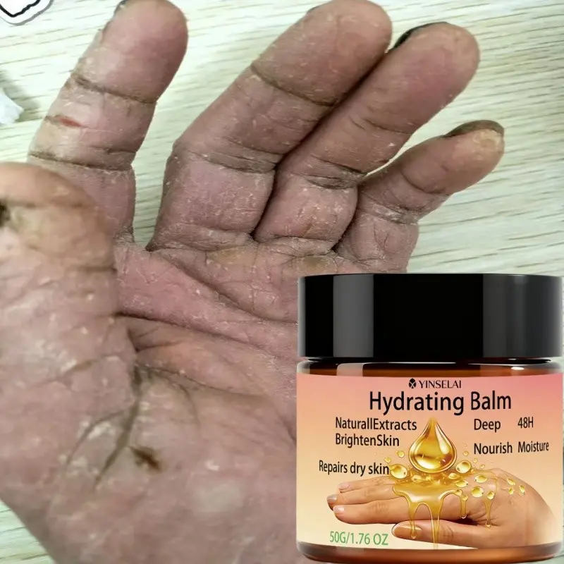 Moisturizing Hand Cream, Gentle and Effective, Nourishes Dry Hands, Reduces Redness and Itching, Smooths and Tightens Skin, Hand Moisturizer