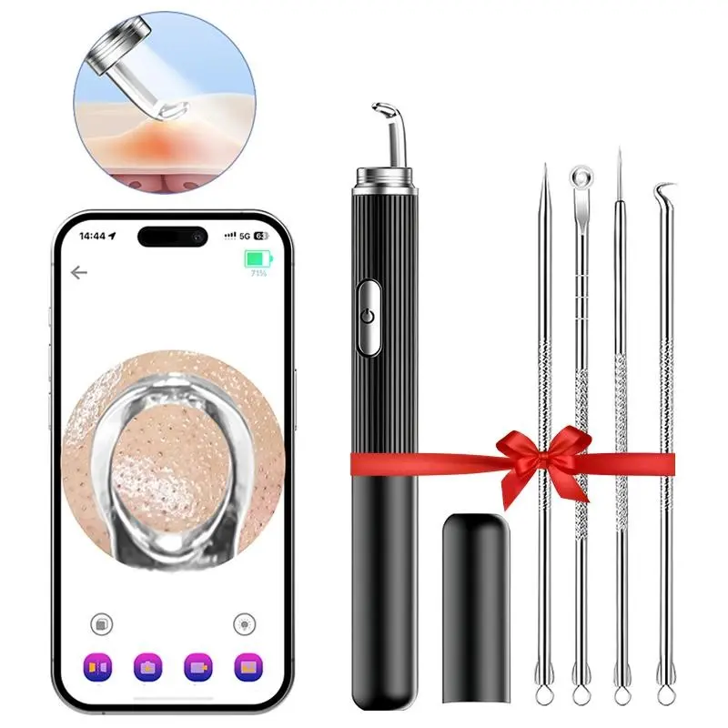 Visible Pores Cleaning Tool with LED Light, WiFi Connected Camera Blackheads Skin Care Device for Acnes Cleaning