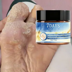 7-Day Foot Care Cream, Anti-Crack Foot Balm, Moisturizing, Nourishing, Softening, Ideal for Dry Cracked Feet, Skin Conditioner, Gift