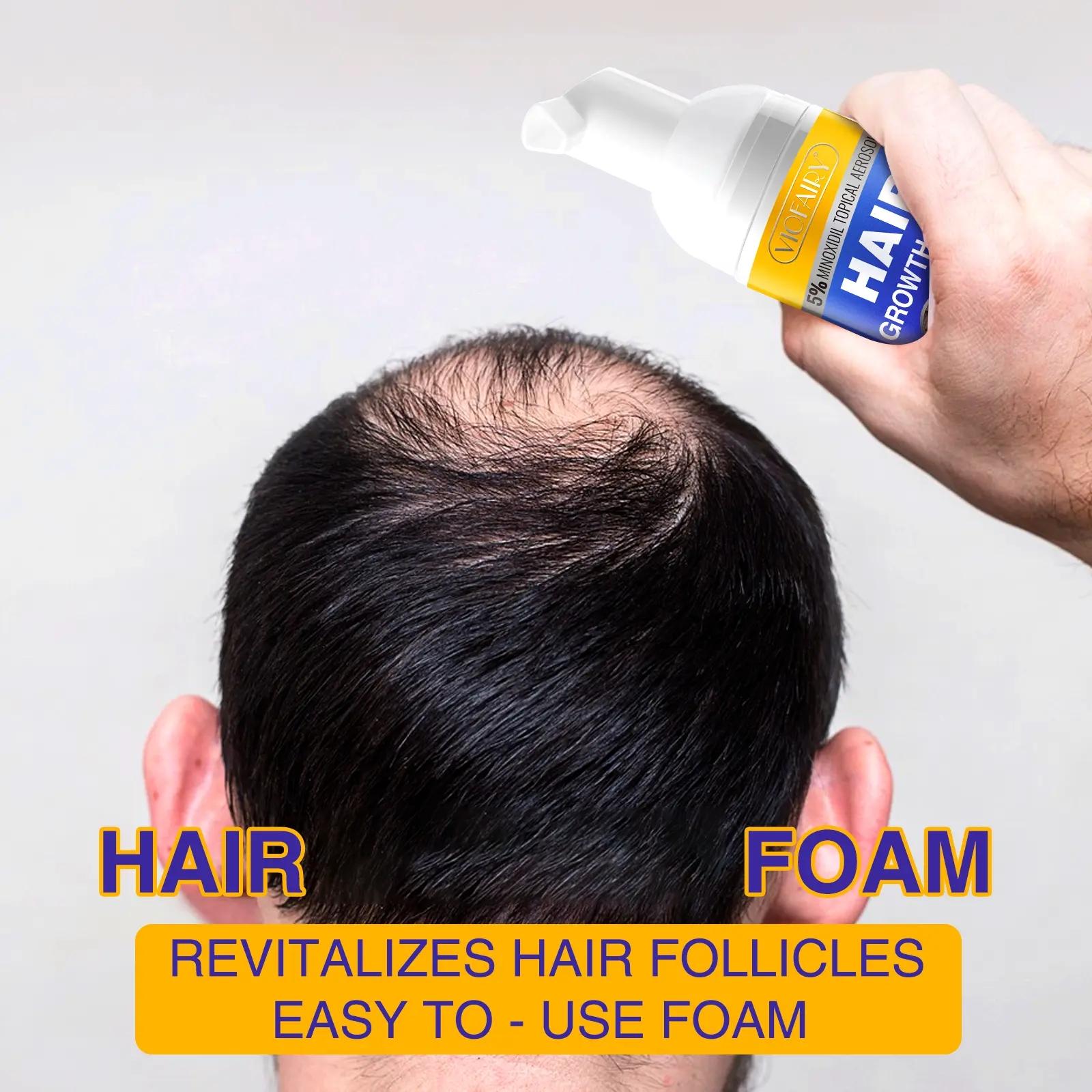 Viofairy Hair Mousse Volumizing Fine Hair for Thicker Hair, Nourishing Formula for Hair Strengthening and Volume, Ideal for Daily Use